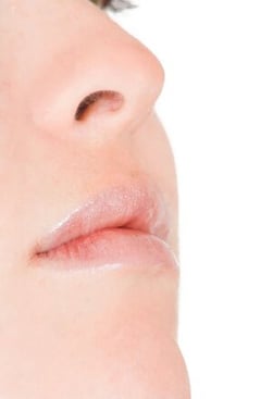 close up of a face with very soft skin